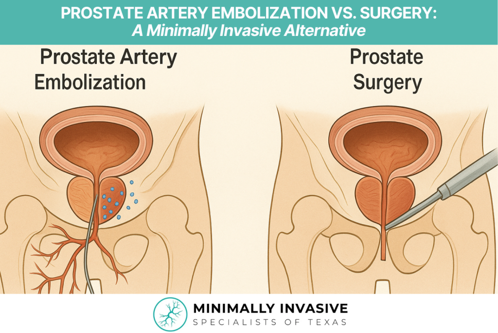 Prostate Artery Embolization vs. Surgery A Minimally Invasive Alternative