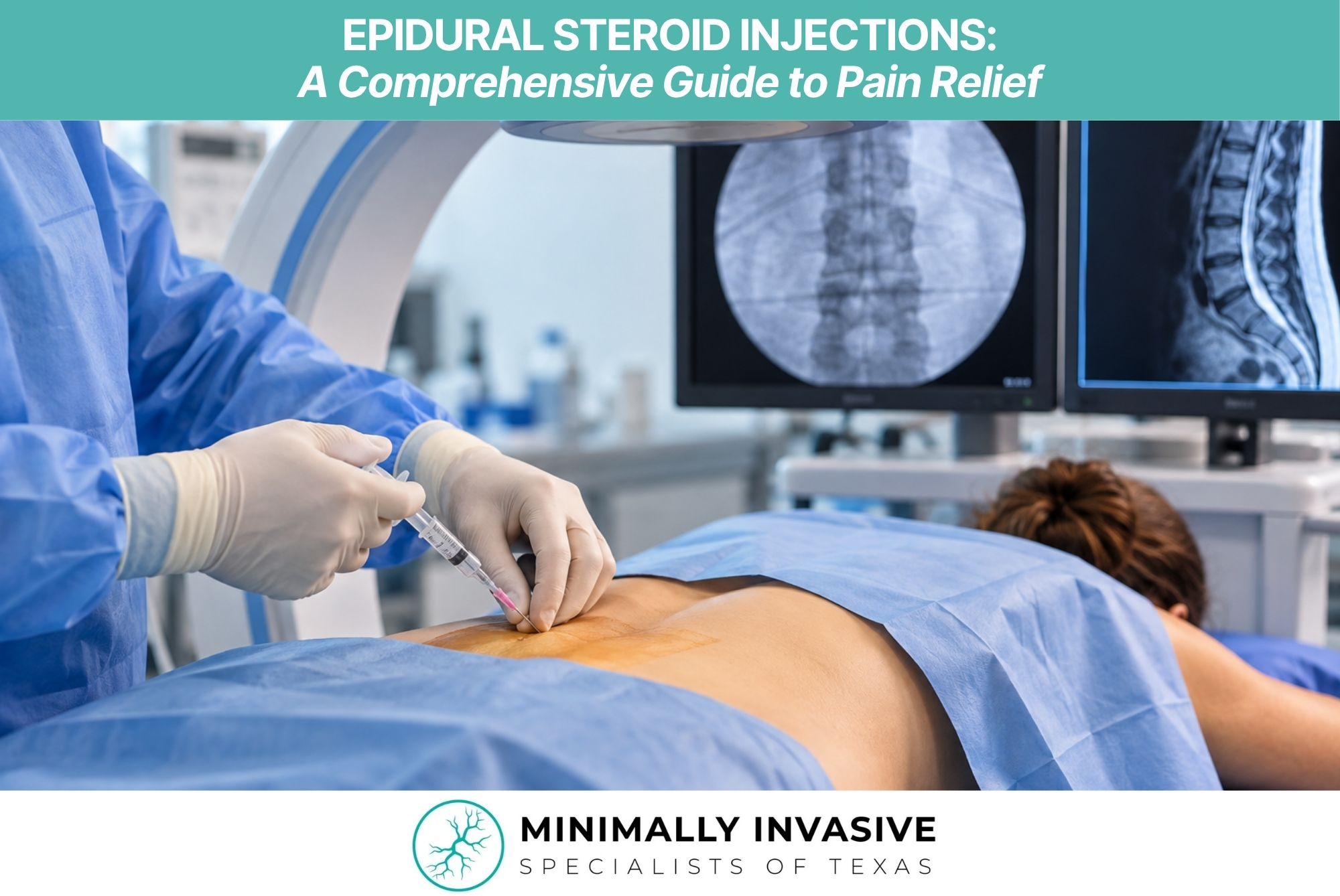 Epidural Steroid Injections: A Minimally Invasive Option for Back, Neck, and Nerve Pain